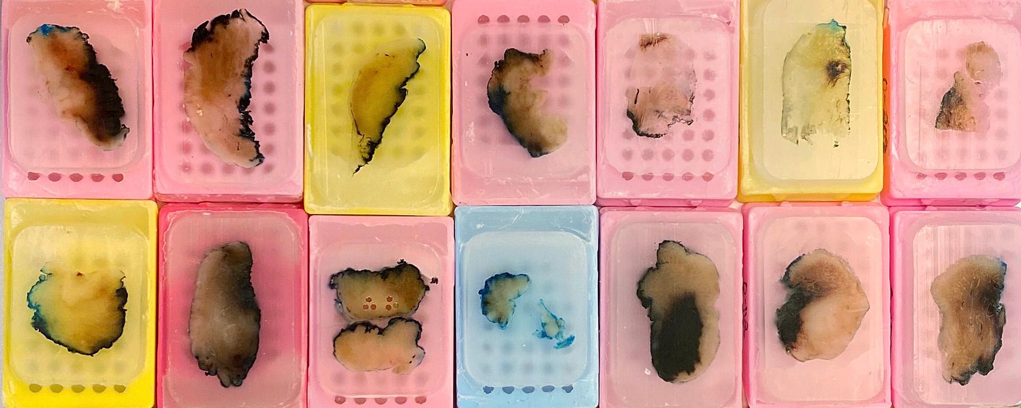 Illustrasjons-/bannerbilde for Experimental Health Research Conference (EHRC) - Mímisbrunnr 2023