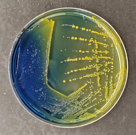 Klebsiella pneumoniae culture rotated_Ken Lindstedt_1x1_1000px.jpg