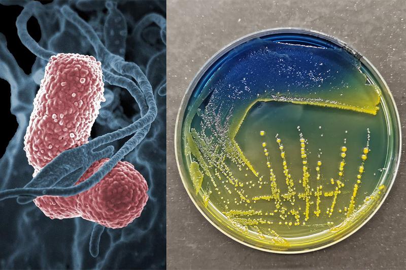 Klebsiella