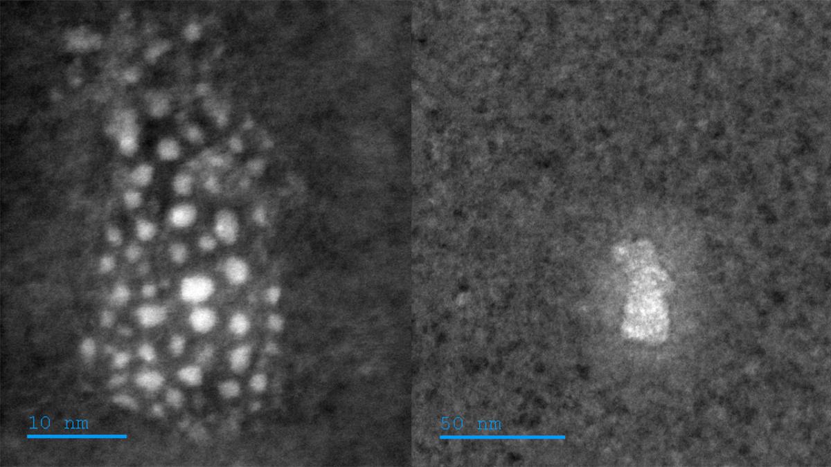 Mikroskopfoto av partikler