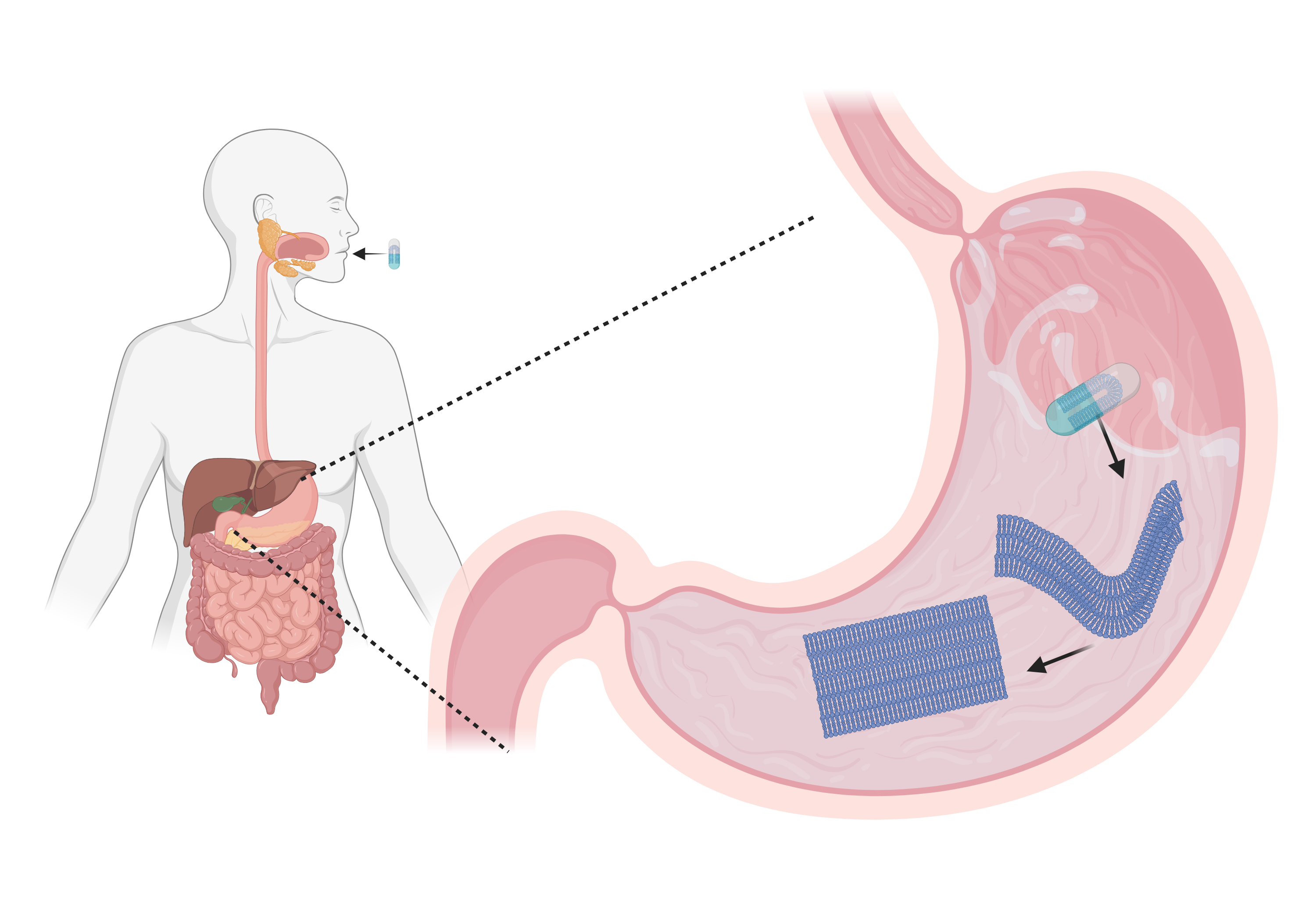 capsule dissolving in the stomach_illustration Ali Raza.jpeg